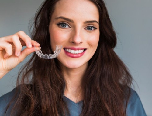 What to Expect With SureSmile® Clear Aligners